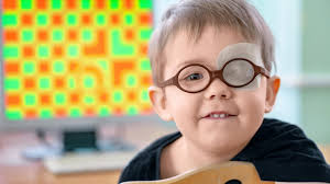 What Is Amblyopia Lazy Eye Dmei Dean Mcgee Eye Institute