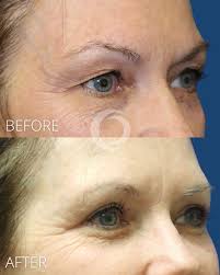 Meet Dr. Kara Criswell—a talented surgeon with a lifelong passion for  artistry and medicine. 💙 Inspired by her father's work as a surgeon, Dr.  Criswell combines her deep respect for the transformative