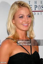 61 Craniosynostosis Stock Photos, High-Res Pictures, and Images