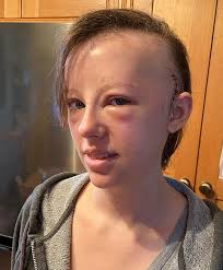 The incredible life of brain cancer campaigner Laura Nuttall and her  extraordinary bucket list