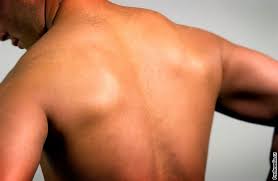 Image result for vyhřezlá ploténka