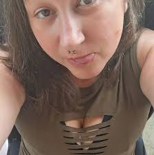 Did decompression surgery help with neck and shoulder pain and migraines?