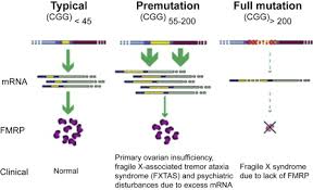 fragile x associated disorders sciencedirect