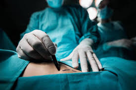 What You Should Know About Cosmetic Surgery In Colombia Miami Herald