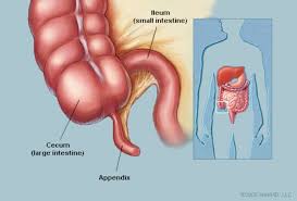 The Appendix Human Anatomy Appendix Picture Definition Function Conditions Tests And Treatments Appendix Cancer Appendix Anatomy Appendix