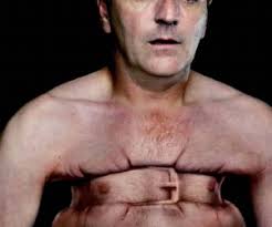 Resultado de imagen para imagenes de dolores en el pecho