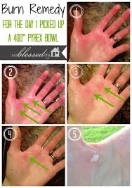 Pin On Household Hints And Tips