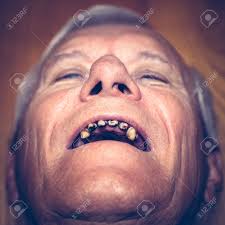 From alice in wonderland, by lewis carroll. Closeup Of An Old Man Face With Ugly Teeth Stock Photo Picture And Royalty Free Image Image 43716341