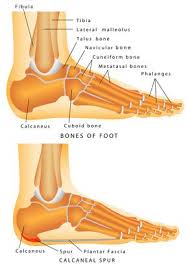 Trauma or injury is a common cause. Heel Pain Heel Spur Treatment Hillsboro Beaverton Clinics