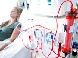 Dialysis Disequilibrium Syndrome Overview