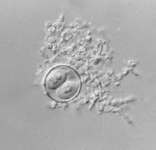 Image result for Cyclospora