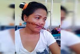 Babae Tinaga Sa Mukha Ng Kaniyang Mister Sa Zamboanga