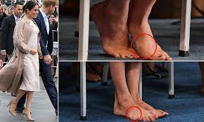 How Meghan S Love Of Heels Has Left Her With A Bunion Meghan Markle Hair Princess Diana Funeral Meghan Markle Style