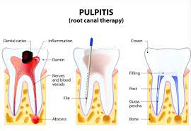 Pin On General Dentistry