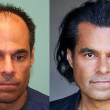 Grateful Head Walnut Creek, CA