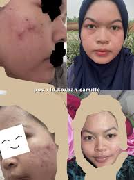 Senyum Cerah Berkat Produk Camille