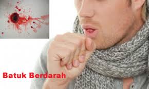Batuk berdarah merupakan tanda adanya kerusakan pembuluh darah yang berada di sekitar saluran pernapasan. Cara Mengobati Batuk Dahak Berdarah Paling Ampuh Jualobatmanjur