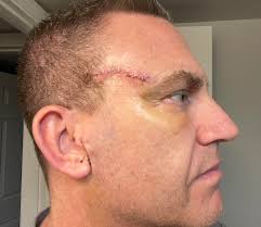 Prayer for Concerns About Moles and Health