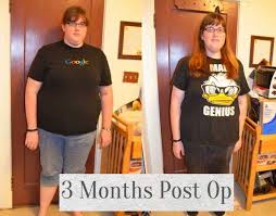 I started to track my food but just can't. 3 Months Before And After Gastric Bypass Obesity Coverage