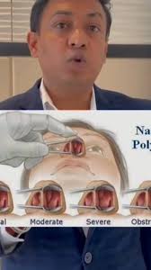 Kangen Water and Allergies