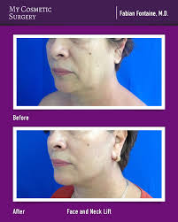 My Cosmetic Surgery Miami