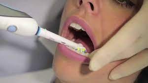 Here are some general tips for brushing your teeth with braces: How To Use An Electric Toothbrush Aj Hedger Youtube
