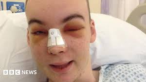 Stoke major trauma centre helps Wrexham crash victim