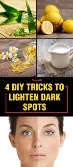 4 Diy Tricks To Lighten Dark Spots Lighten Dark Spots Dark Spots Remedies Dark Spots On Legs