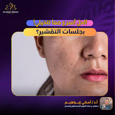 أ د . أماني إبراهيم Dr.Amany Ibrahim Skin and Laser Clinic