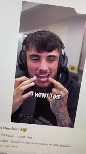 Danny Aarons Teeth Before and After