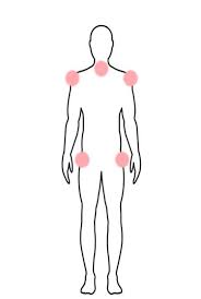 Image result for Polymyalgia Rheumatica