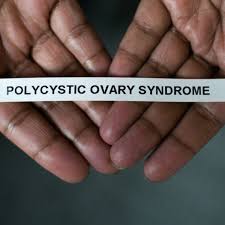 Natural remedies for pcos symptoms. Overdiagnosis And Disease Labels The Case Of Polycystic Ovary Syndrome