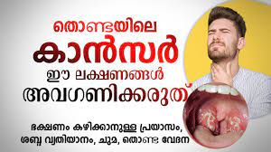 It plays an important role in helping you breathe and speak. à´¤ à´£ à´Ÿà´¯ à´² à´• àµ»à´¸àµ¼ à´ˆ à´²à´• à´·à´£à´™ à´™àµ¾ à´…à´µà´—à´£ à´• à´•à´° à´¤ Throat Cancer Youtube