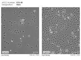 Vero cells have at times been indispensable to the study of coronaviruses. Vero Atcc