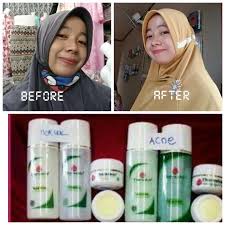 All pettit ablative antifouling paints discounted off msrp! Pengalaman Pribadi Memakai Paket Theraskin