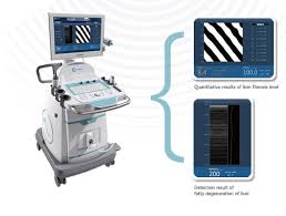 Hisky Med Fibrotouch For Sale Bimedis Id1352478 Medical Equipment Med Ophthalmic Equipment