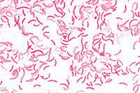 Abstract a new species of halophilic anoxygenic purple bacteria of the genus rhodospirillum is described. Rhodospirillum Rubrum Chromogenic Rods Smear Instruments Direct