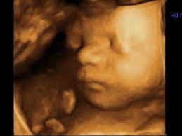 Da kind und gebärmutter unter anderem auf darm und magen drücken, sollten sie. Unser Baby In Der 29 Woche Youtube