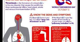 Deep Vein Thrombosis With Bi Lateral Pulmonary Embolism Is The Diagnosis I Was Given In October Of 201 Deep Vein Thrombosis Vein Thrombosis Pulmonary Embolism
