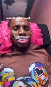 Lip enlargement. 😍 So men do join ladies de do BBL. Wahala de ooo. What's  your take