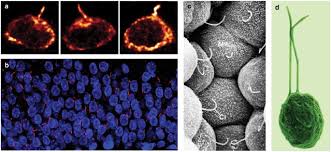 Check spelling or type a new query. Cilium Generated Signaling And Cilia Related Disorders Laboratory Investigation