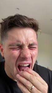 Dealing with Loss of Taste Buds: Coping Strategies and Tips