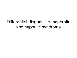 O membranous (most common in adults) o minimal change disease (most common in children) o history in nephrotic syndrome · presenting complaint o oedema o foaming urine o thrombotic complication: Differential Diagnosis Of Nephrotic And Nephritic Syndrome Prezentaciya Onlajn