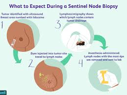 How do allergies cause fatigue? Lymph Node Positive Breast Cancer Symptoms And Treatment