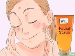 Wayne's home renovation projects (whrp) augenbrauen rasieren: 3 Ways To Remove The Redness Of A Pimple Wikihow