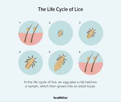 Image result for lice vs nits