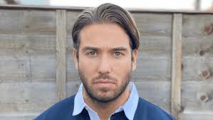 James Lock Hair Transplant at KSL Clinic // See the results here