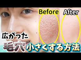 手遅れになる前に 毛穴を小さくする正しい方法 のままはダメ youtube 毛穴 小さく 顔 毛穴 フェイスケア