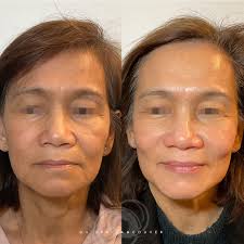 2024 Holiday Facial Promotion