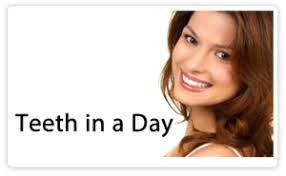 Dental Implants San Diego